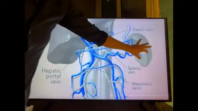 أضرار الإفراط في شرب الماء.. ماذا يحدث للكبد والجسم عند تجاوز الحد؟ 💧 الدكتور ضياء العوضي
