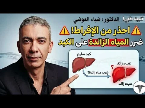 أضرار الإفراط في شرب الماء.. ماذا يحدث للكبد والجسم عند تجاوز الحد؟ 💧 الدكتور ضياء العوضي