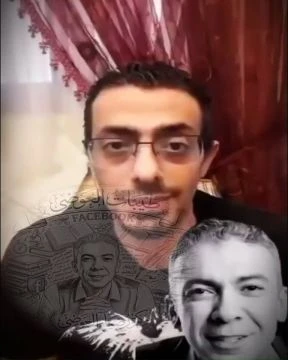 د ضياء العوضي حالة صدفية شديدة
